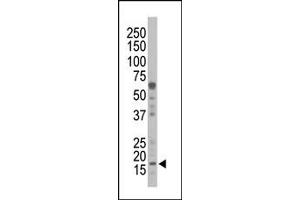 Image no. 1 for anti-Non-Metastatic Cells 1, Protein (NM23A) Expressed in (NME1) (N-Term) antibody (ABIN360544) (NME1 Antikörper  (N-Term))