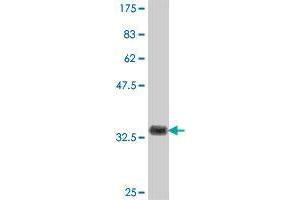 Western Blot detection against Immunogen (37. (USP21 Antikörper  (AA 466-565))