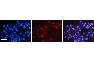MXD4 antibody - N-terminal region          Formalin Fixed Paraffin Embedded Tissue:  Human Lung Tissue    Observed Staining:  Nucleus of pneumocytes   Primary Antibody Concentration:  1:100    Other Working Concentrations:  1/600    Secondary Antibody:  Donkey anti-Rabbit-Cy3    Secondary Antibody Concentration:  1:200    Magnification:  20X    Exposure Time:  0. (MXD4 Antikörper  (N-Term))