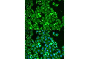 Immunofluorescence analysis of HeLa cells using STAT1 antibody (ABIN5998976). (STAT1 Antikörper)