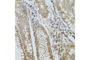 Immunohistochemistry (IHC) image for anti-Selectin P (Granule Membrane Protein 140kDa, Antigen CD62) (SELP) (AA 30-200) antibody (ABIN6147503)
