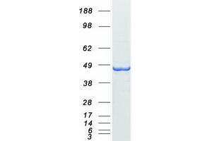 Western Blotting (WB) image for alpha-Methylacyl-CoA Racemase (AMACR) (Transcript Variant 1) protein (Myc-DYKDDDDK Tag) (ABIN2714645)