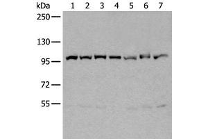 Western blot analysis of 231 Hela A549 A431 HEPG2 Jurkat and K562 cell lysates using VCP Polyclonal Antibody at dilution of 1:400 (VCP Antikörper)