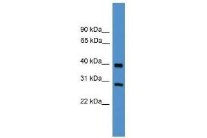 TIMP2 antibody used at 0. (TIMP2 Antikörper  (Middle Region))