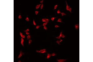 ABIN6275032 staining Hela by IF/ICC. (C1S Antikörper  (C-Term))