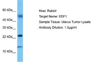Host: Rabbit Target Name: EDF1 Sample Type: Uterus Tumor lysates Antibody Dilution: 1. (EDF1 Antikörper  (N-Term))