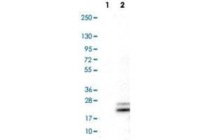 Western Blot analysis of Lane 1: negative control (vector only transfected HEK293T cell lysate) and Lane 2: over-expression lysate (co-expressed with a C-terminal myc-DDK tag in mammalian HEK293T cells) with RNASE7 monoclonal antibody, clone CL0224 . (RNASE7 Antikörper)