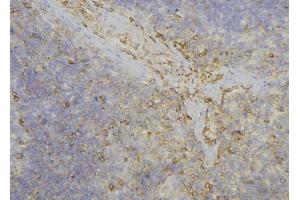 ABIN6277719 at 1/100 staining Human lymph node tissue by IHC-P. (ADH6 Antikörper)