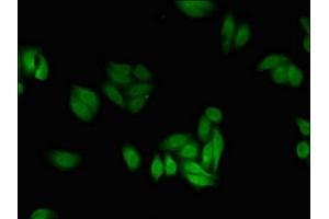 Immunofluorescent analysis of HepG2 cells using ABIN7142693 at dilution of 1:100 and Alexa Fluor 488-congugated AffiniPure Goat Anti-Rabbit IgG(H+L) (PFKFB2 Antikörper  (AA 360-505))