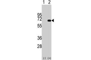 Western blot analysis of AFP (arrow) using rabbit AFP polyclonal antibody . (alpha Fetoprotein Antikörper  (Internal Region))