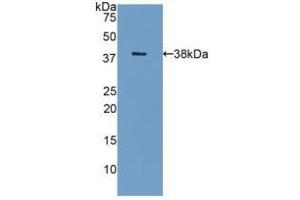 Detection of Recombinant GAL8, Human using Polyclonal Antibody to Galectin 8 (GAL8) (LGALS8 Antikörper  (AA 1-317))