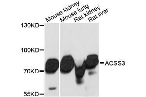 Western blot analysis of extracts of various cell lines, using ACSS3 antibody. (ACSS3 Antikörper)