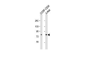 Western Blot at 1:1000 dilution Lane 1: CCRF-CEM whole cell lysate Lane 2: Jurkat whole cell lysate Lysates/proteins at 20 ug per lane. (MT-ND5 Antikörper  (C-Term))