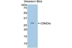 Western Blotting (WB) image for anti-Pyridoxal Kinase (PDXK) (AA 29-253) antibody (ABIN1860178) (PDXK Antikörper  (AA 29-253))