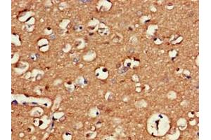 Immunohistochemistry of paraffin-embedded human brain tissue using ABIN7154490 at dilution of 1:100