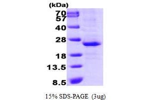 SDS-PAGE (SDS) image for Lin-28 Homolog A (C. Elegans) (LIN28A) (AA 42-209) protein (His tag) (ABIN667750)