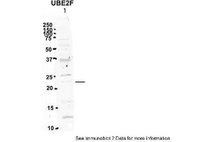 Sample Type: 1. (UBE2F Antikörper  (N-Term))