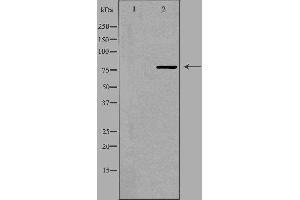 Western blot analysis of extracts from K562 cells, using TBX3 antibody.