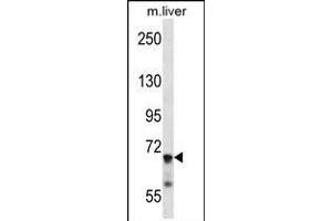 IL1R1 Antibody (C-term) (ABIN657915 and ABIN2846862) western blot analysis in mouse liver tissue lysates (35 μg/lane). (IL1R1 Antikörper  (C-Term))