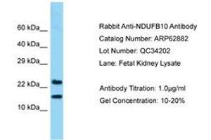 Image no. 1 for anti-NADH Dehydrogenase (Ubiquinone) 1 beta Subcomplex, 10, 22kDa (NDUFB10) (AA 91-140) antibody (ABIN6749956) (NDUFB10 Antikörper  (AA 91-140))