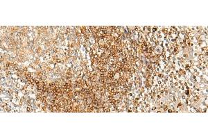Immunohistochemistry (Paraffin-embedded Sections) (IHC (p)) image for anti-Major Histocompatibility Complex, Class II, DP alpha 1 (HLA-DPA1) antibody (ABIN7245233)