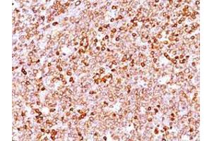 Immunohistochemical staining (Formalin-fixed paraffin-embedded sections) of human tonsil with CD79A recombinant monoclonal antibody, clone IGA/1688R . (Rekombinanter CD79a Antikörper  (AA 208-222))