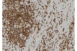 ABIN6260073 and ABIN6278423 at 1/100 staining Human gastric tissue by IHC-P. (ASCL1 Antikörper  (C-Term))