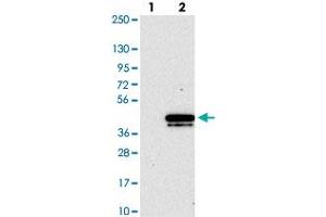 Western blot analysis of Lane 1: Negative control (vector only transfected HEK293T lysate). (CHMP4B Antikörper)
