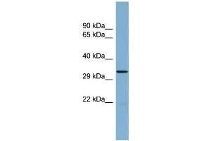 WB Suggested Anti-THG1L Antibody Titration:  0. (THG1L Antikörper  (Middle Region))