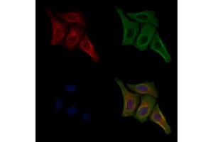 ABIN7093228 and ABIN7097240 staining HepG2 cells(4h of LPS treatment) by IF/ICC. (Insulin Receptor Antikörper  (pTyr1355))