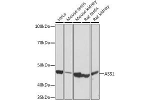 Western blot analysis of extracts of various cell lines, using  Rabbit mAb (ABIN7265669) at 1:1000 dilution. (ASS1 Antikörper)
