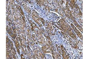 IHC analysis of FRY using anti-FRY antibody (ABIN7599716). (FRY Antikörper  (AA 11-3013))