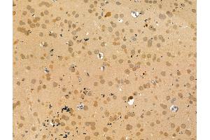 ABIN7094482 and ABIN7098531 at 1/100 staining Rat brain tissue by IHC-P. (TEAD4 Antikörper  (N-Term))