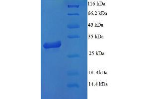 SDS-PAGE (SDS) image for Microtubule-Associated Protein 1S (MAP1S) (AA 794-1053), (partial) protein (His tag) (ABIN4976268) (MAP1S Protein (AA 794-1053, partial) (His tag))