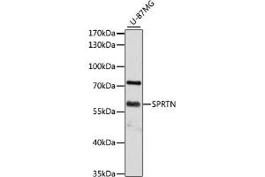 Western blot analysis of extracts of U-87MG cells, using SPRTN antibody (ABIN6131455, ABIN6148388, ABIN6148390 and ABIN6215311) at 1:3000 dilution. (Spartan Antikörper  (AA 1-240))