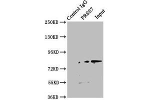 Immunoprecipitating PRSS7 in Jurkat whole cell lysate Lane 1: Rabbit control IgG instead of ABIN7151805 in Jurkat whole cell lysate. (TMPRSS15 Antikörper  (AA 40-300))