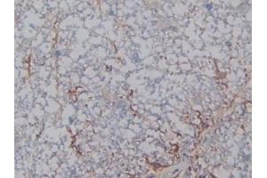 Immunohistochemistry (IHC) image for anti-Heparanase (HPSE) (AA 40-188) antibody (ABIN7437449)