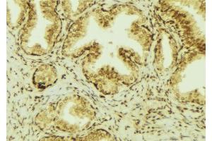 ABIN6277469 at 1/100 staining Mouse colon tissue by IHC-P. (CHI3L1 Antikörper  (Internal Region))
