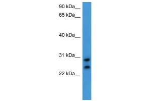 WB Suggested Anti-CEACAM7 Antibody Titration: 0. (CEACAM7 Antikörper  (C-Term))