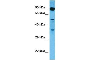 Host:  Rat  Target Name:  DMTF1  Sample Tissue:  Rat Skeletal Muscle  Antibody Dilution:  1ug/ml (DMP1 Antikörper  (C-Term))