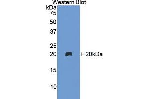 Western blot analysis of the recombinant protein. (Hemoglobin Subunit beta Antikörper  (AA 1-147))
