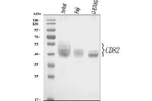 Western blot analysis of CD82 using anti-CD82 antibody (ABIN3043486). (CD82 Antikörper  (AA 98-267))