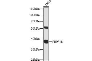 Western blot analysis of extracts of HeLa cells, using PRPF18 antibody (ABIN6132207, ABIN6146254, ABIN6146255 and ABIN6216579) at 1:3000 dilution. (PRPF18 Antikörper  (AA 1-342))