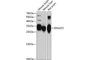 Western blot analysis of extracts of various cell lines, using DN antibody (ABIN6127737, ABIN6139724, ABIN6139725 and ABIN6214762) at 1:1000 dilution. (DNAJC5 Antikörper  (AA 1-198))