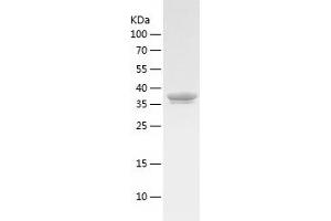 Western Blotting (WB) image for UDP-Galactose-4-Epimerase (GALE) (AA 1-348) protein (His tag) (ABIN7125646)
