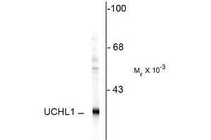 Image no. 1 for anti-Ubiquitin Carboxyl-terminal Esterase L1 (Ubiquitin Thiolesterase) (UCHL1) antibody (ABIN372739) (UCHL1 Antikörper)