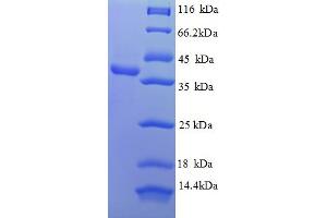 SDS-PAGE (SDS) image for Apurinic/Apyrimidinic Endonuclease 1 (APEX1) (AA 32-318) protein (His tag) (ABIN5709055) (APEX1 Protein (AA 32-318) (His tag))