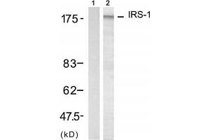 Western blot analysis of extract from 293 cell, using IRS-1 (Ab-312) Antibody (E021166, Lane 1 and 2). (IRS1 Antikörper)