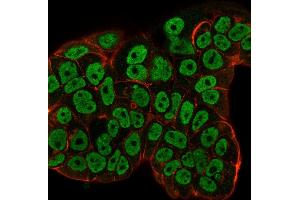 Immunofluorescence (IF) image for anti-Estrogen Receptor 1 (ESR1) (AA 129-312) antibody (ABIN6939346)