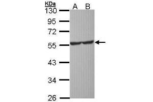 WB Image Sample (30 ug of whole cell lysate) A: Molt-4 , B: Raji 10% SDS PAGE antibody diluted at 1:1000 (Serotonin Receptor 1A Antikörper)